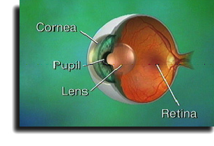 refractive eye surgery