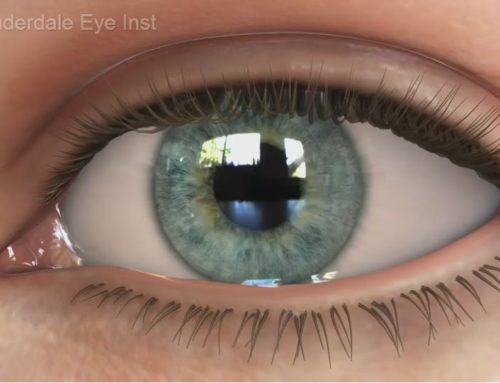 Refractive Errors and Eye Diseases