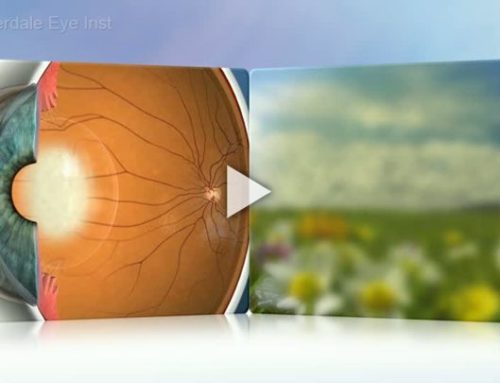 Cataracts: Treatment Overview