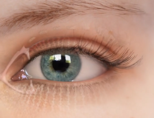 Dry Eye Testing – Introduction