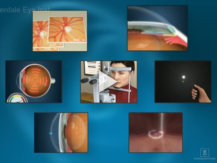 Glaucoma Testing Overview