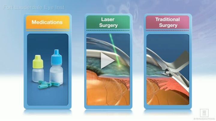 Glaucoma Treatment Overview