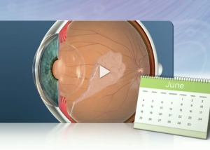 intravitreal injections