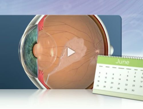 Intravitreal Injections: Post-Op