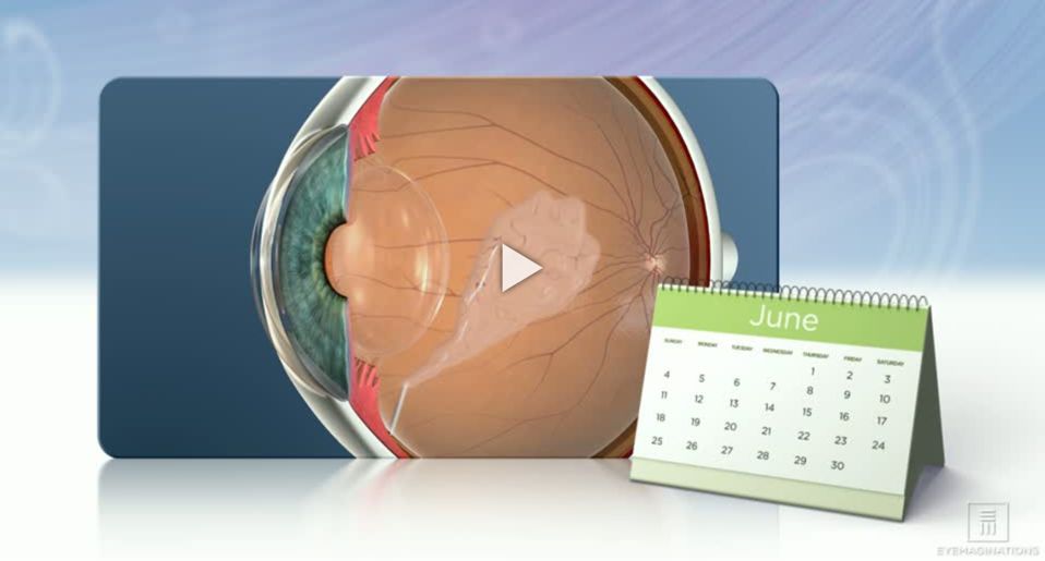 intravitreal injections