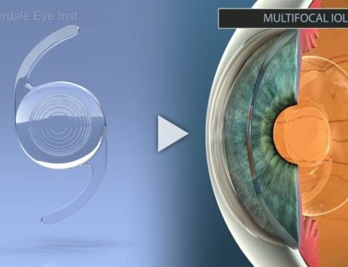 IOL: Multifocal – Introduction