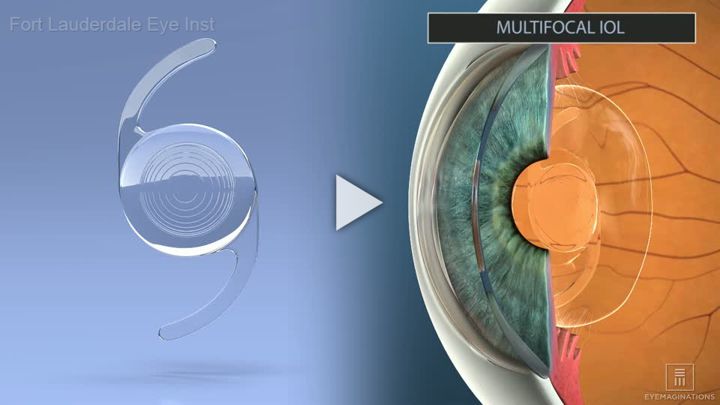 IOL Multifocal Introduction