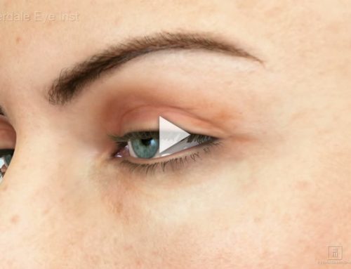 Ptosis: Overview