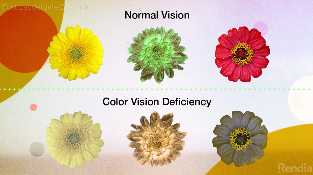 3 Types of Color Blindness (Symptoms, Tests & Treatments)