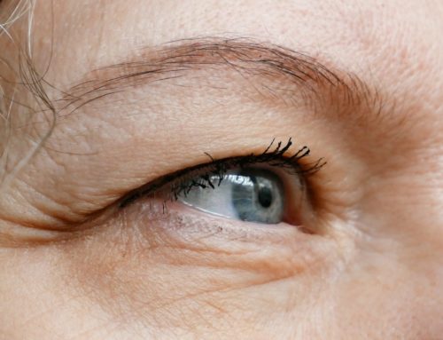 Ptosis Causes and Treatment