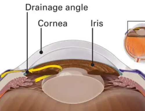 aqueous-humor-and-its-role-in-the-eye-fort-lauderdale-eye-institute