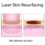 What is Laser Skin Resurfacing?