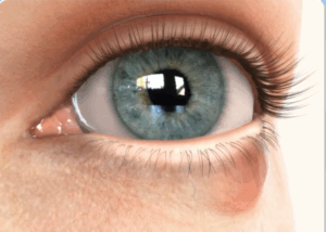 chalazion: overview 9 chalazion