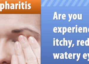 what is blepharitis? 10 what is blepharitis
