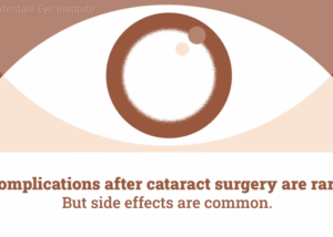 cataract surgery: side effects 7 cataract surgery side effects