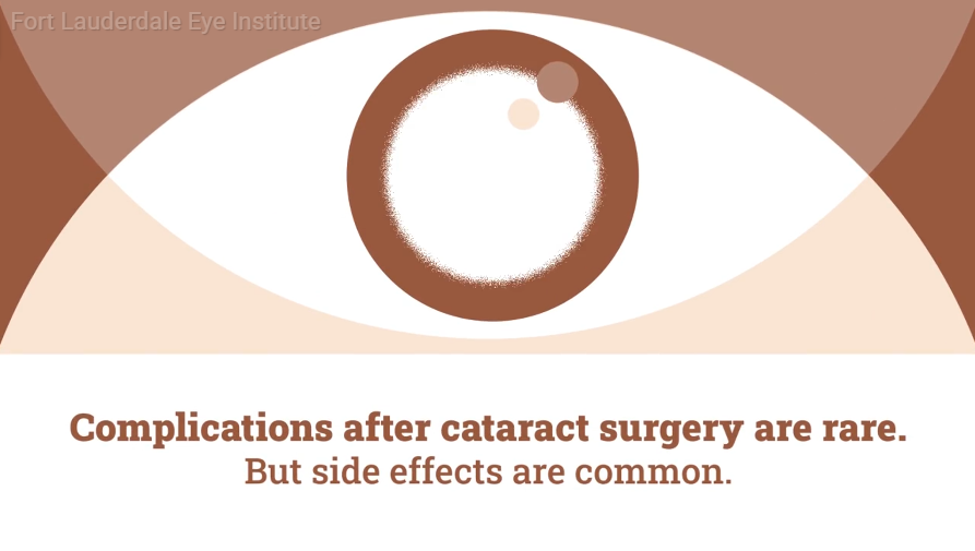 cataract surgery side effects