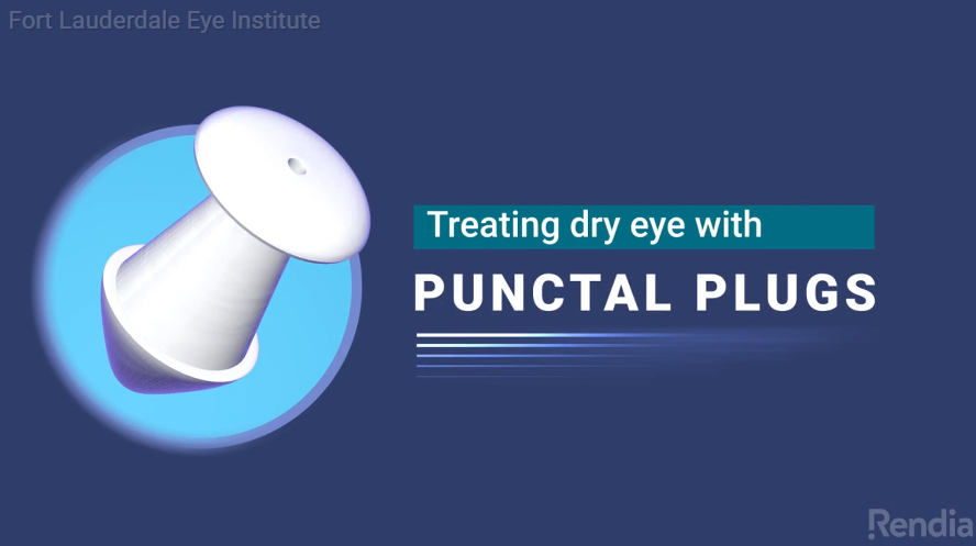 punctal plugs dry eye